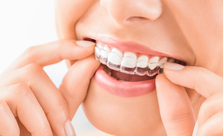 Qualified Invisalign Treatment Provider