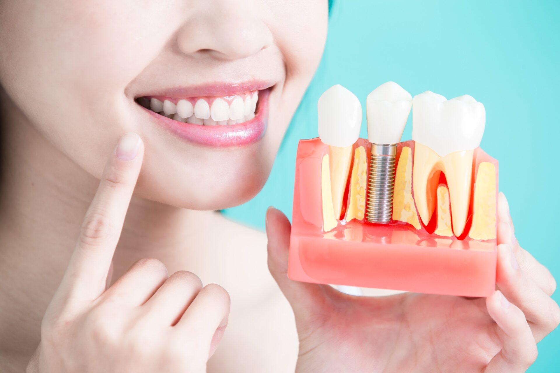 Dental Implants and More Cosmetic Dentistry Services in Rockford